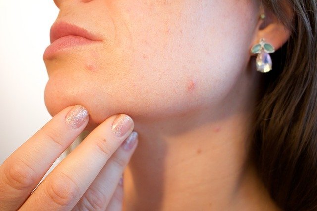 Tips dan Cara Agar Tidak Berjerawat Ketika Menggunakan Make up