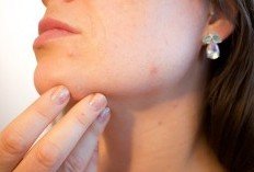 Tips dan Cara Agar Tidak Berjerawat Ketika Menggunakan Make up
